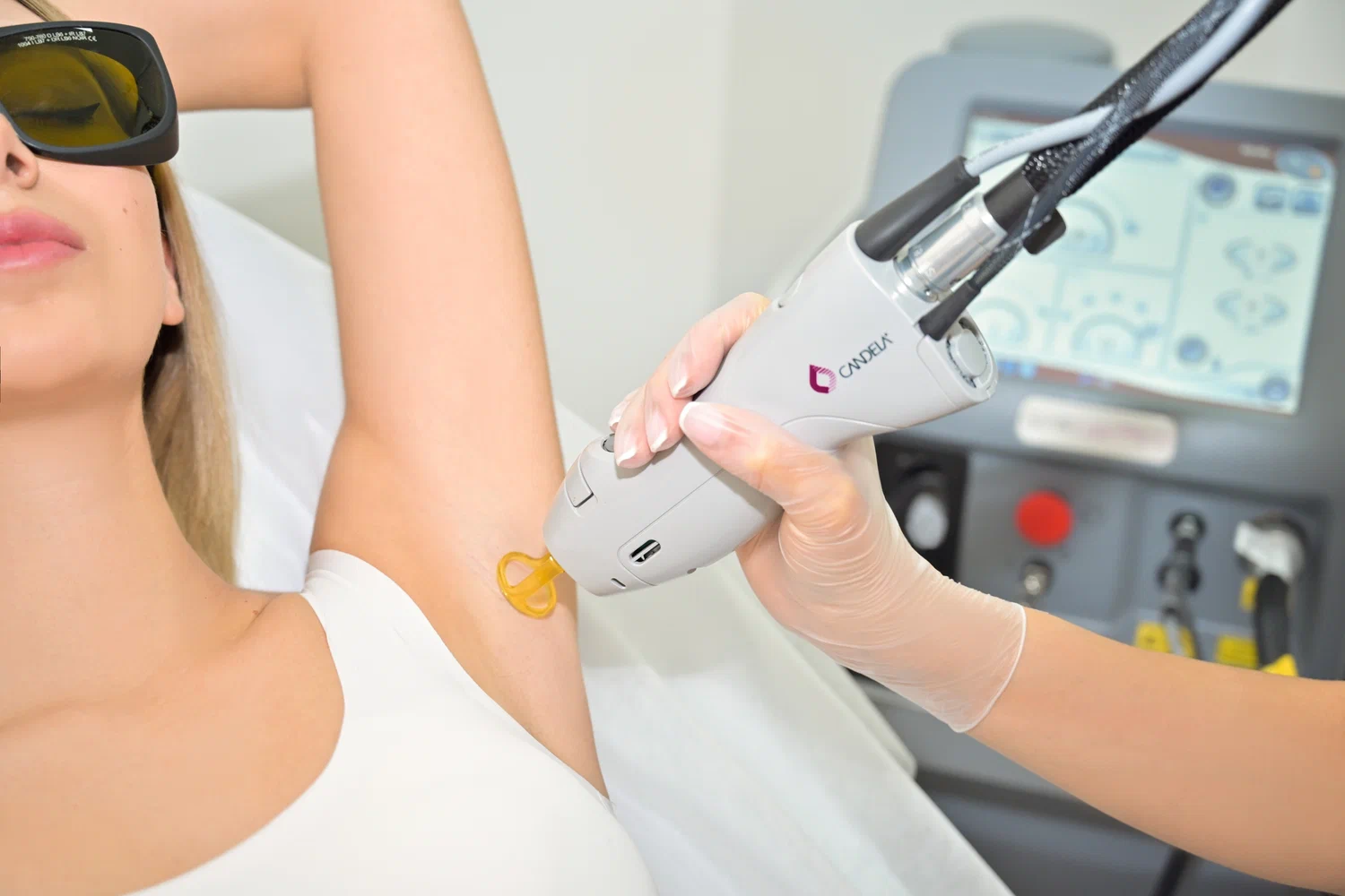 Lot to know about laser hair removal? Cost- effective laser hair removal becomes easy in south delhi